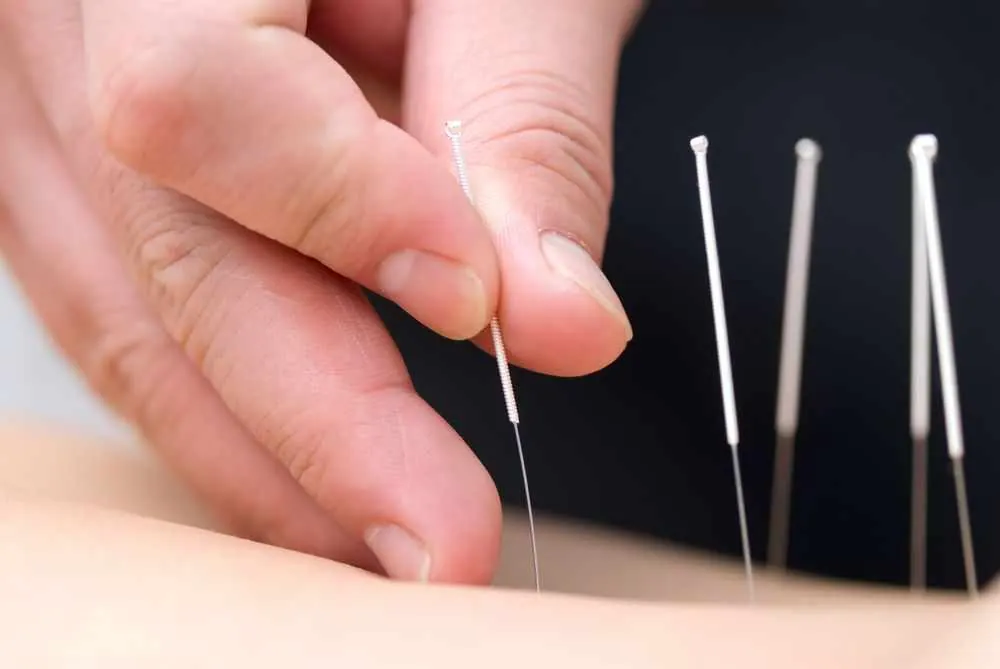 Acupuncture Medical Billing Service